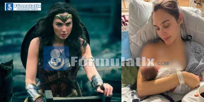 Gal-Gadot-enfrento-una-cirugia-d